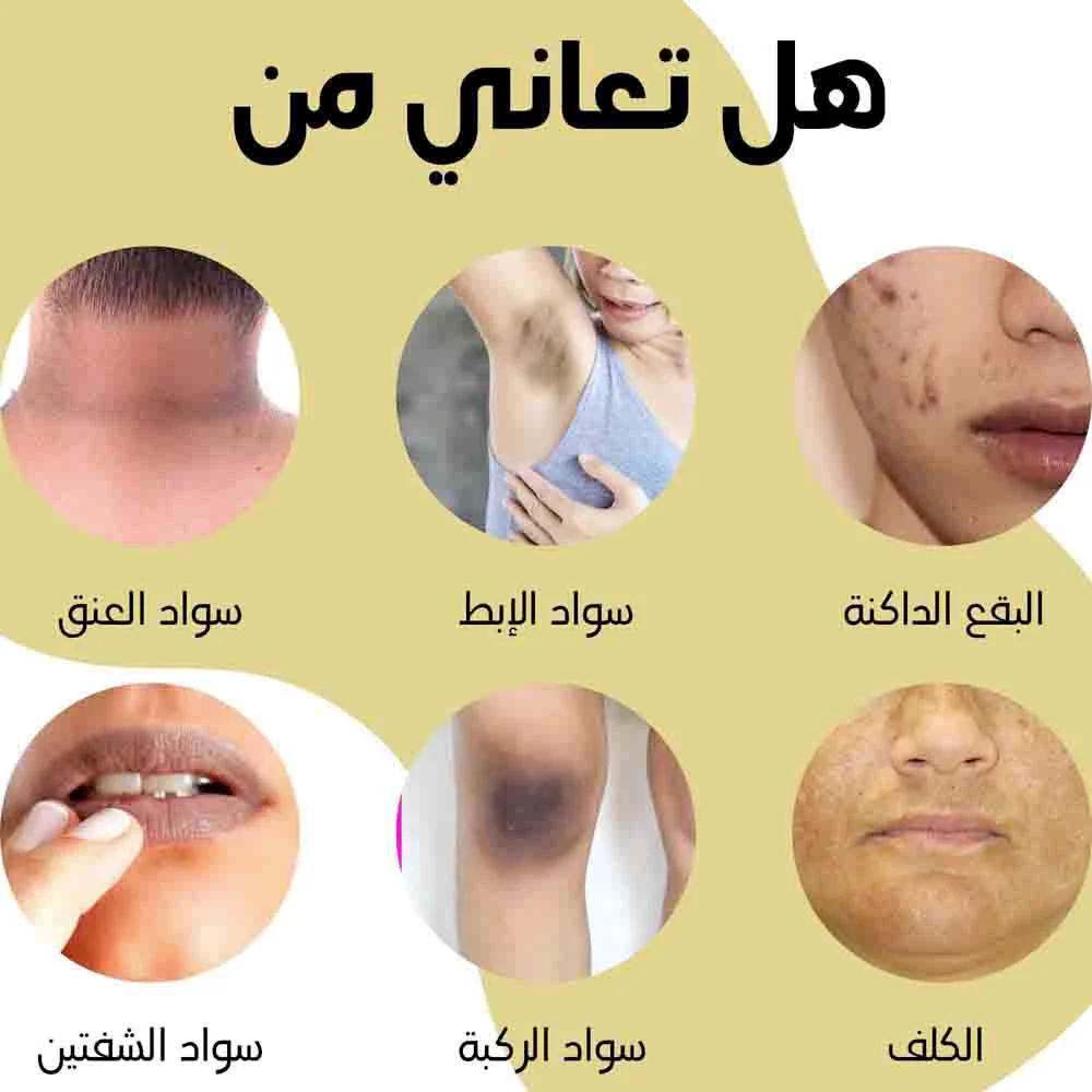Laisha Yellow Peeling Oil